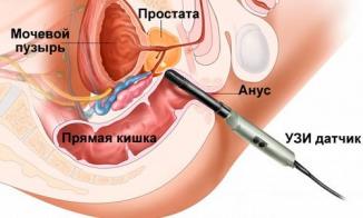 трузи