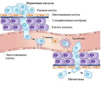 как образуются метастазы